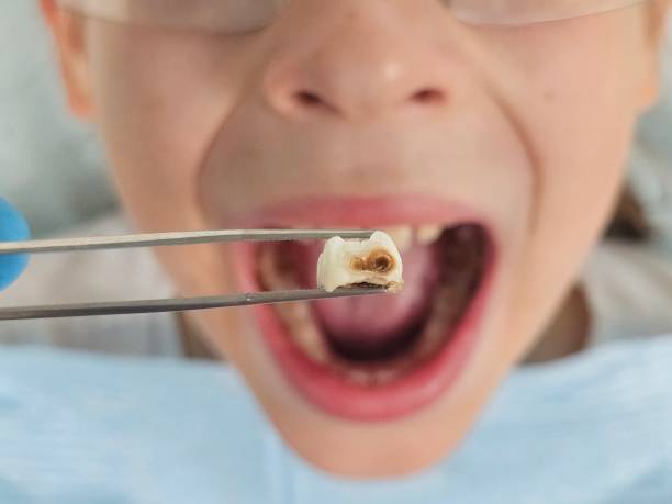 Emergency Gum Pain Relief in NY